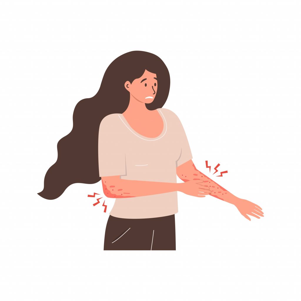 Affections cutanées et muqueuses professionnelles de mécanisme allergique