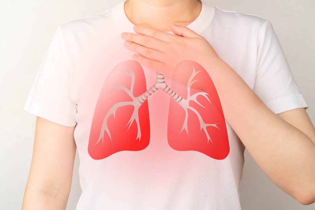 Cancer broncho-pulmonaire provoqué par l'inhalation de poussières ou fumées renfermant du cadmium
