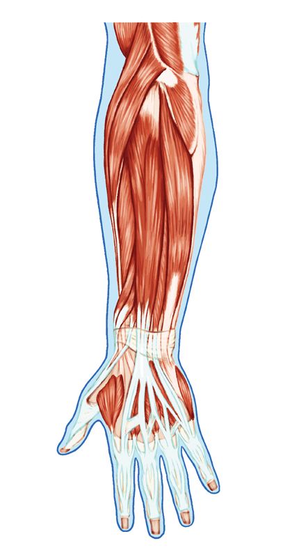 Séquelles musculaires et tendineuses